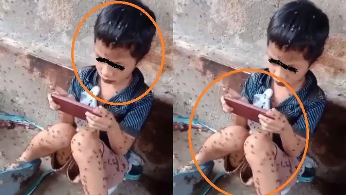 VIRAL Bocah Asyik Main HP Padahal Tubuhnya Dikerubungi Ratusan Lalat, Videonya Bikin Merinding