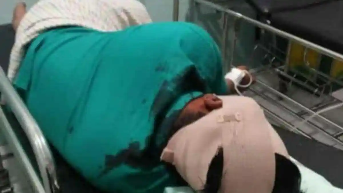Seorang Perawat di Bantul Dibacok Orang Misterius pada Jumat Dinihari, Polisi Telusuri CCTV