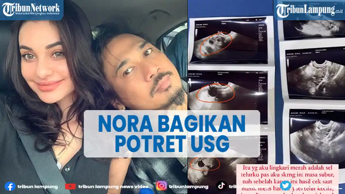Nora Alexandra Istri Jerinx SID Posting Foto USG