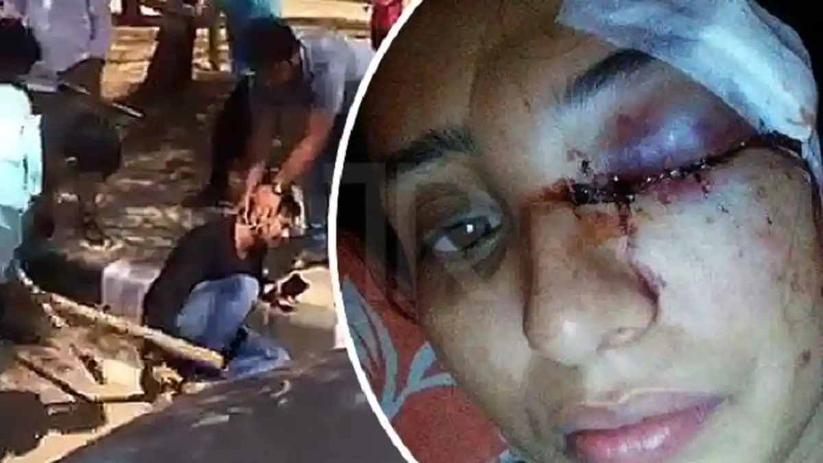 Teganya Sang Suami Pukuli Istrinya Hingga Keguguran, Mata Lebam Mengeluarkan Darah dan Nanah