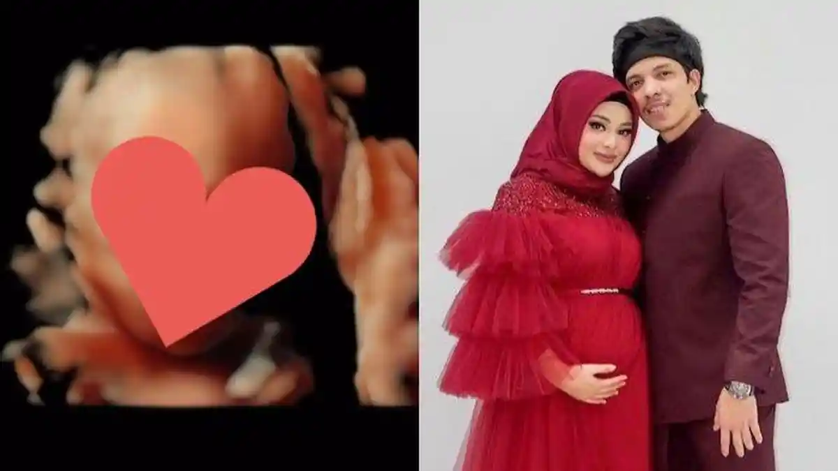 Aurel Hermansyah Sebut Calon Bayinya Plek Ketiplek Atta Halilintar, 'Mamanya Gak Kedapatan'