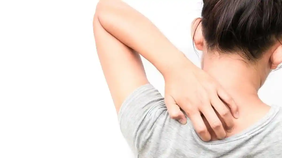 Sepele Sih, Tapi Gatal-gatal Bisa Sangat Mengganggu, Ini Penyebab dan Cara Mengatasinya