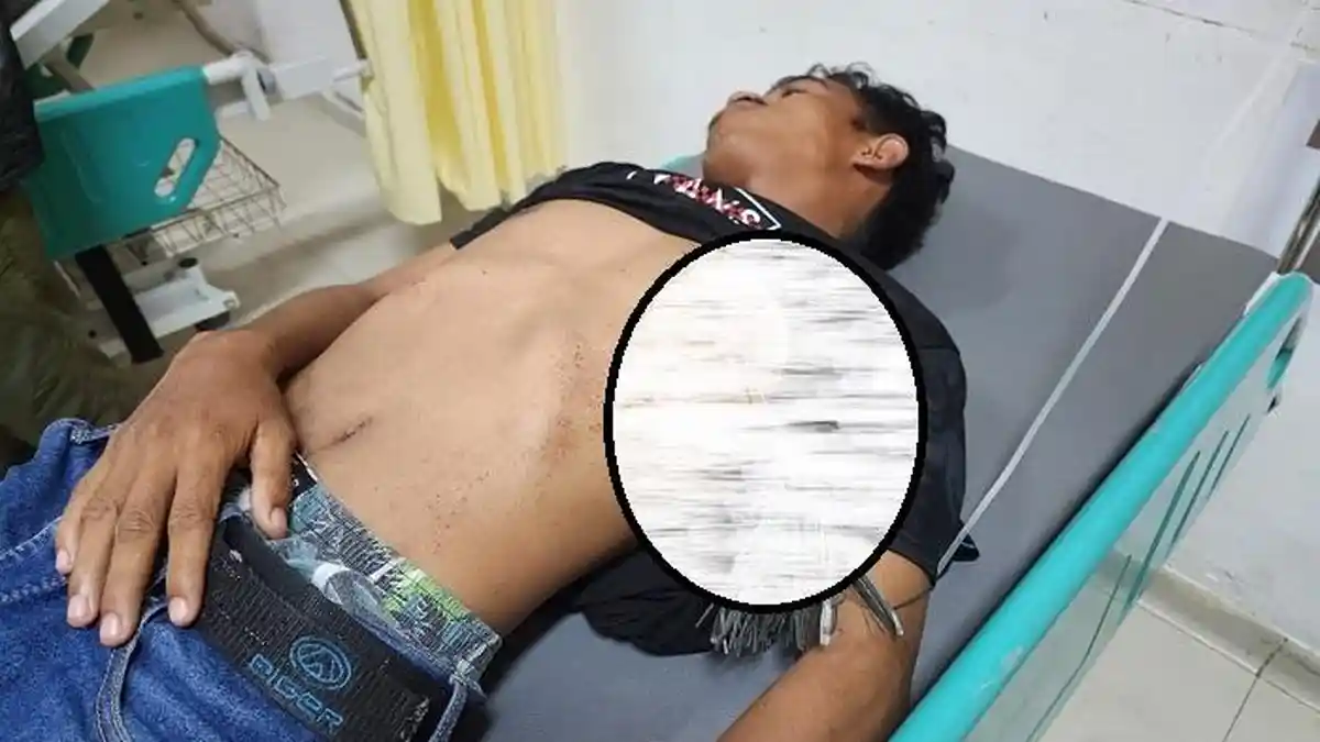Hendak Beli Rokok di Warung Mahasiswa di Kendari Dibusur Bagian Dadanya, Harus Dioperasi