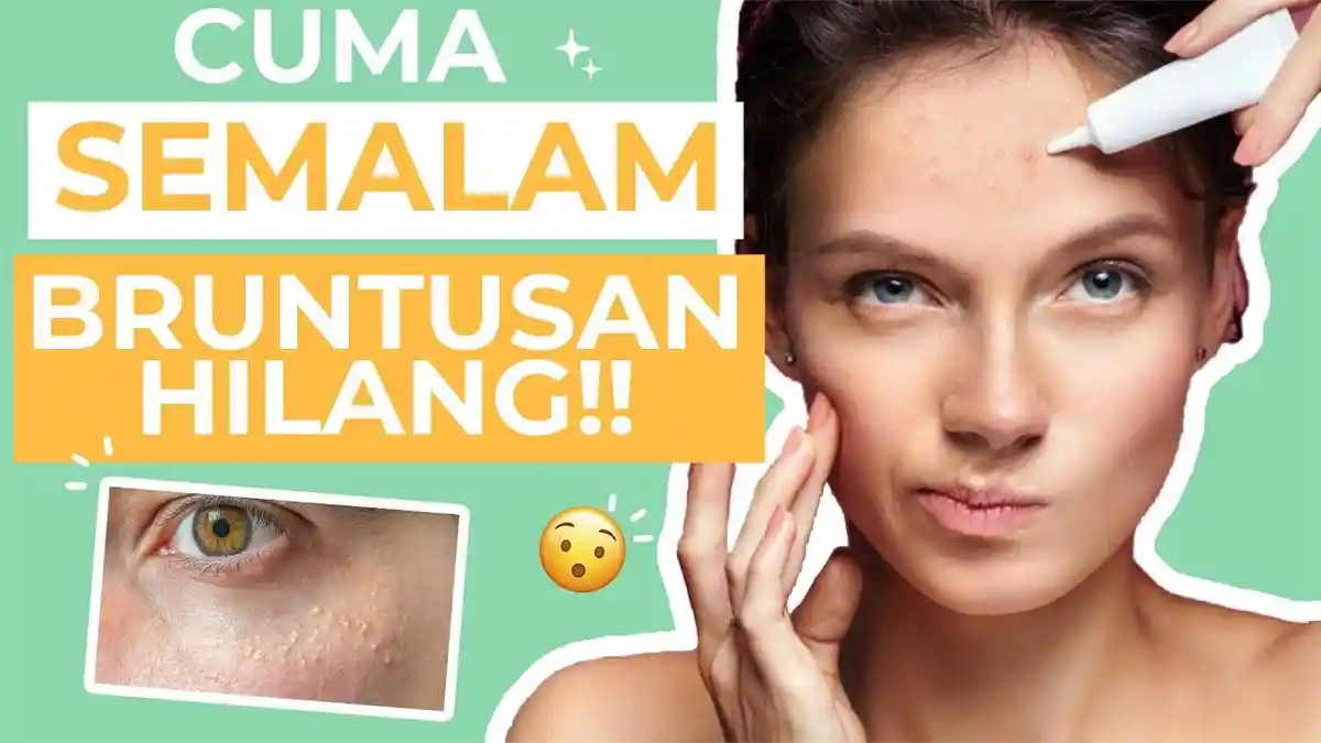 5 Cara Mengobati Bruntusan Dengan Bahan Dapur Cuka Apel, Teh Hijau, Putih Telur Dijamin Hilang!