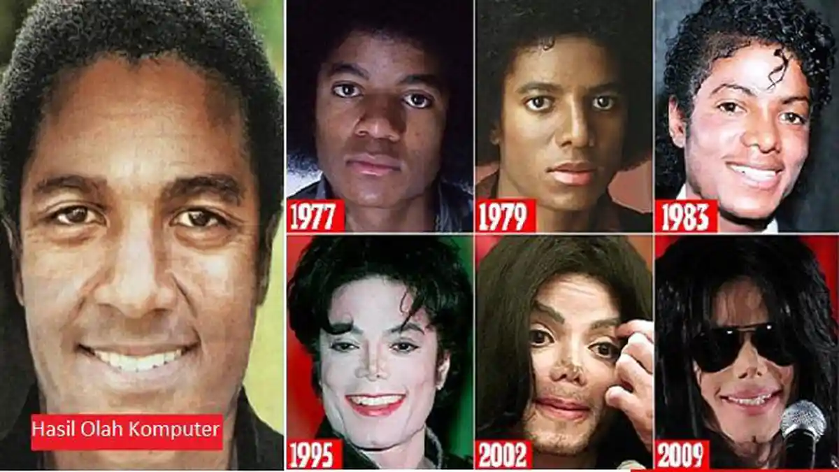 Wajah Michael Jackson Andai Tak Dioperasi Plastik