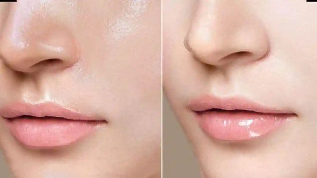 Perbedaan Kulit Berminyak dan Glowing, Berikut Tips Mendapatkan Kulit Sehat