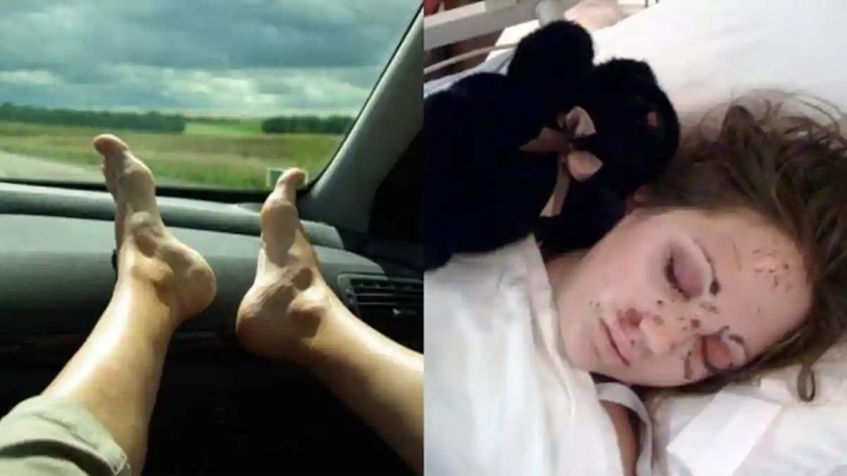 Wanita Ini Tertidur dengan Kaki di Atas Dashboard, Tragedi Setelahnya Langsung Mengubah Hidupnya!