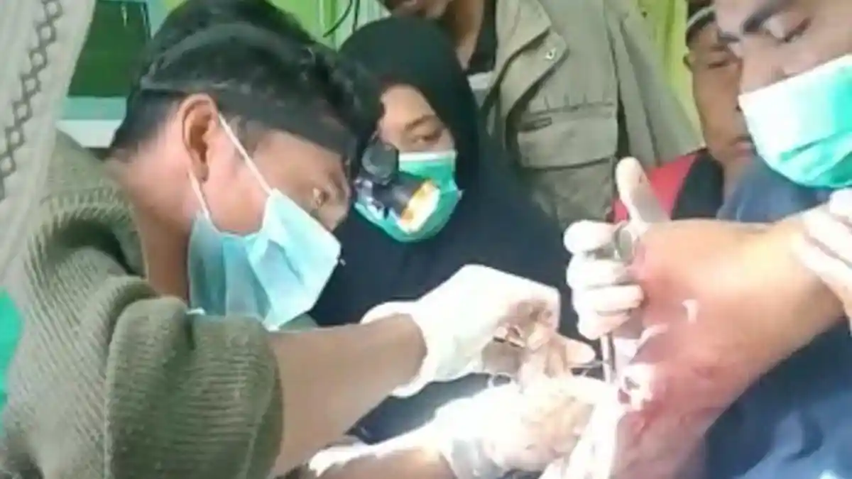 Cerita Pemuda asal Nagan Raya Lepas dari Gigitan Ular Piton saat Mencari Ikan di Sungai