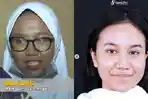 potret-mayang-sesudah-dan-sebelum-permak-wajah.jpg