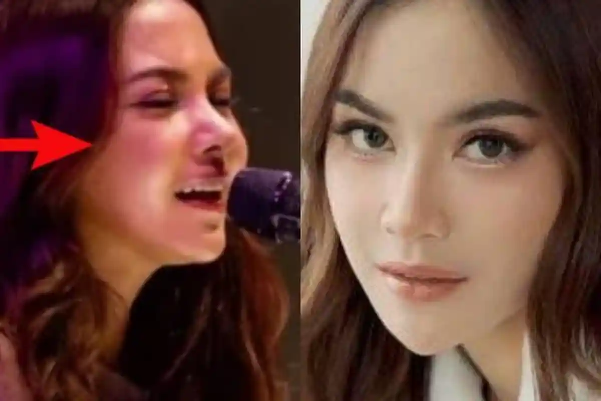 Bukannya Dapat Pujian, Mahalini Dihujat Gegara Diduga Operasi Hidung, Istri Rizky Nangis di Panggung