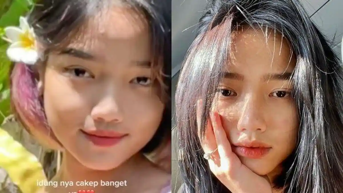 MAKIN CANTIK, Fuji Diduga Lakukan Operasi Hidung, Intip Transformasi Wajah Pacar Thariq Halilintar