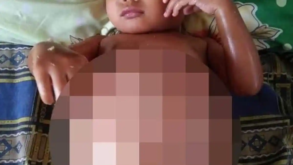 Mari Bantu 'Laurenz' Bayi 2 Tahun 4 Bulan Melawan Tumor Ganas di Ginjal