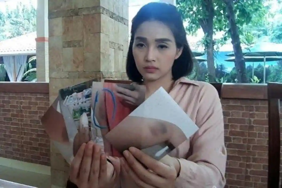 Sedang Makan Siang dengan Ibu, Perempuan Cantik Ini Dianiaya Kakak Sendiri, Dituduh Sebar Informasi