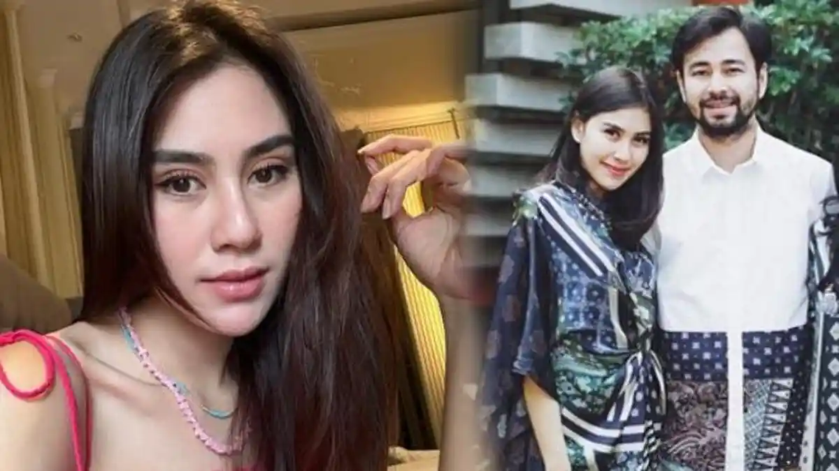 Beda Wajah Syahnaz Sadiqah Dulu dan Sekarang Diduga Oplas, Hidung Adik Raffi Ahmad Jadi Sorotan