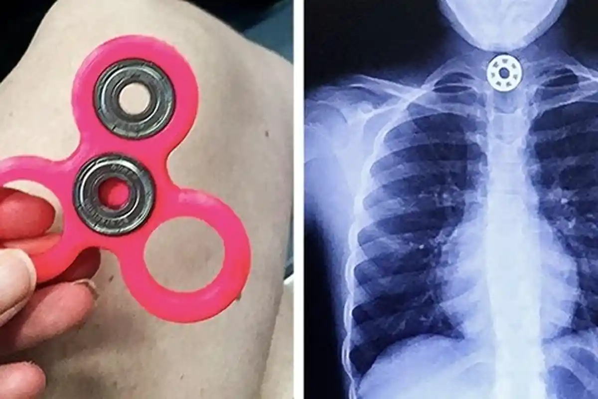 FOTO: Awas, 8 Mainan Berbahaya yang Ini Mungkin Sudah Anda Berikan ke Anak Anda