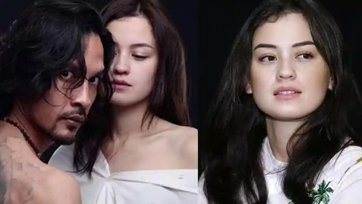 Minta Cerai dari Suami, Kimberly Rider Beberkan Bukti KDRT Edward Akbar, Ditampar hingga Lebam