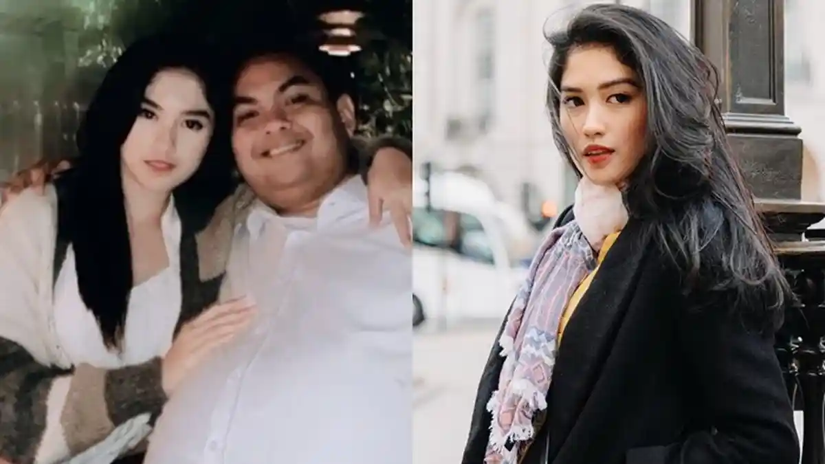 Profil Ochi Rosdiana, Pemeran Julia di Sinetron 17+, Pengusaha dan Sudah Bertunangan!