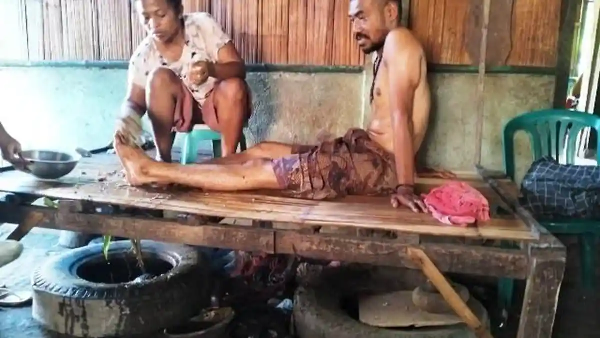 Akibat Dianiaya 11 Pemuda, Guru SDK Watuhdoge, Nagekeo Belum Bisa Makan