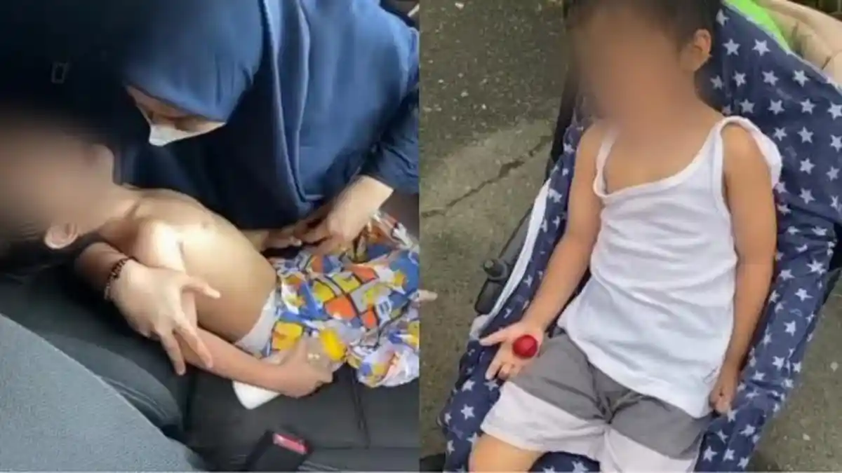 Anak 4 Tahun Alami Patah Tulang Diduga Dianiaya Guru PAUD, Begini Kronologinya