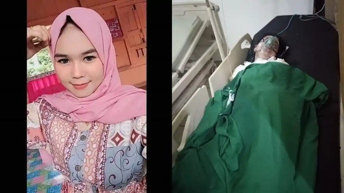 Tak Terima Diputus, Oknum Polisi di Lahat Sumatera Selatan Nekat Bakar Pacarnya, Ini Kata Kapolres