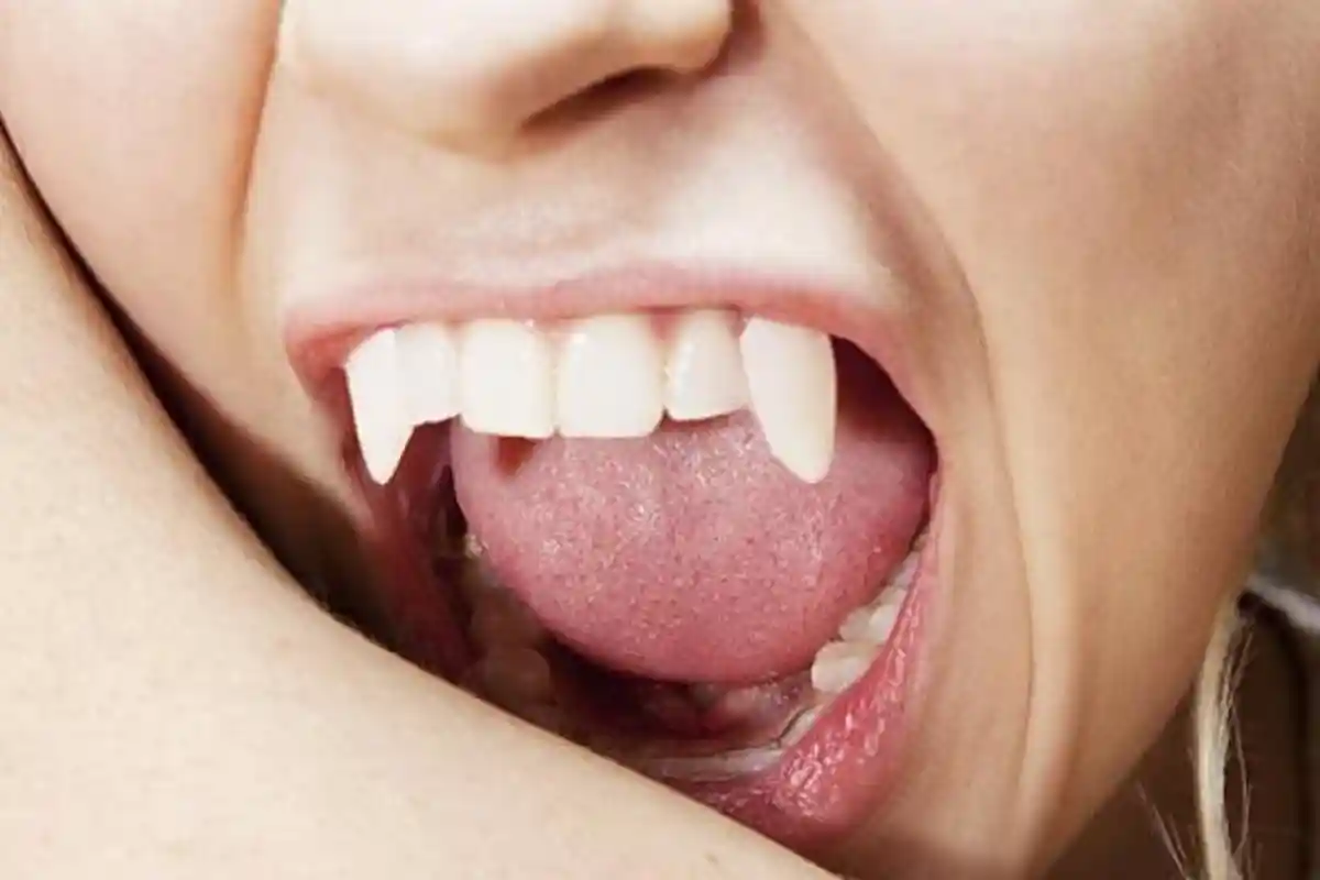 Pengakuan Pengendara Motor yang Gigit Telinga Kondektur Bus Hingga Putus: Kesal Tak Bisa Nyalip