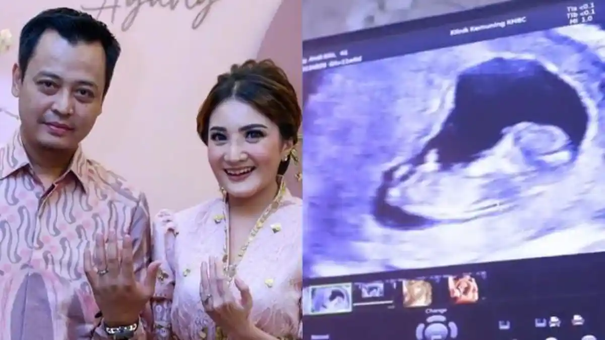 Hamil di Umur 42 Tahun, Kiki Amalia Ingin Melahirkan Normal