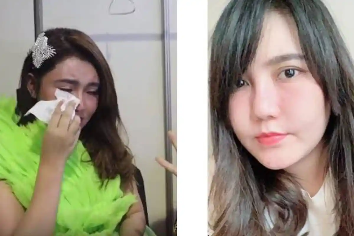 Tangisan Depresi Via Vallen Setelah Wajahnya Bengkak, Curhat yang Sebenarnya, Perawatan Gagal Total