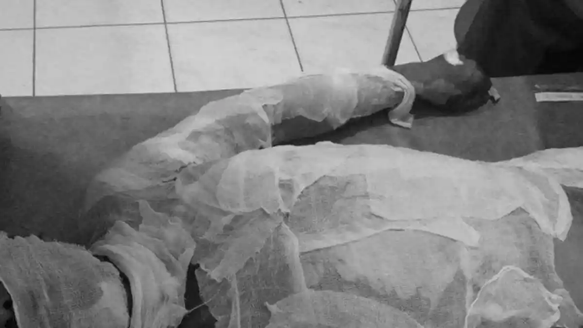 Tolak Ajakan Makan Bersama, Kiki Dibakar Suaminya, Disiram Premium Seliter