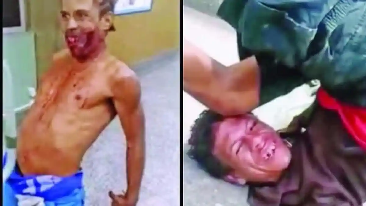 Mengerikan, Efek Narkoba Flakka Membuat Pemakainya Seperti Mayat Hidup