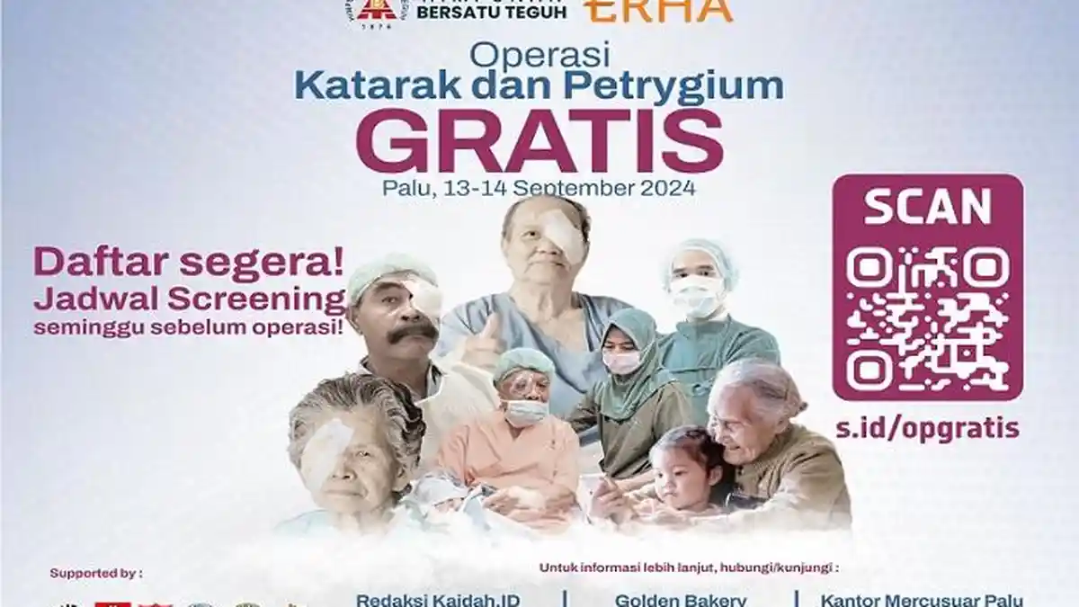 Roa Jaga Roa Ajak Warga Ikuti Operasi Katarak dan Pterygium Gratis di Palu, Cek Waktunya