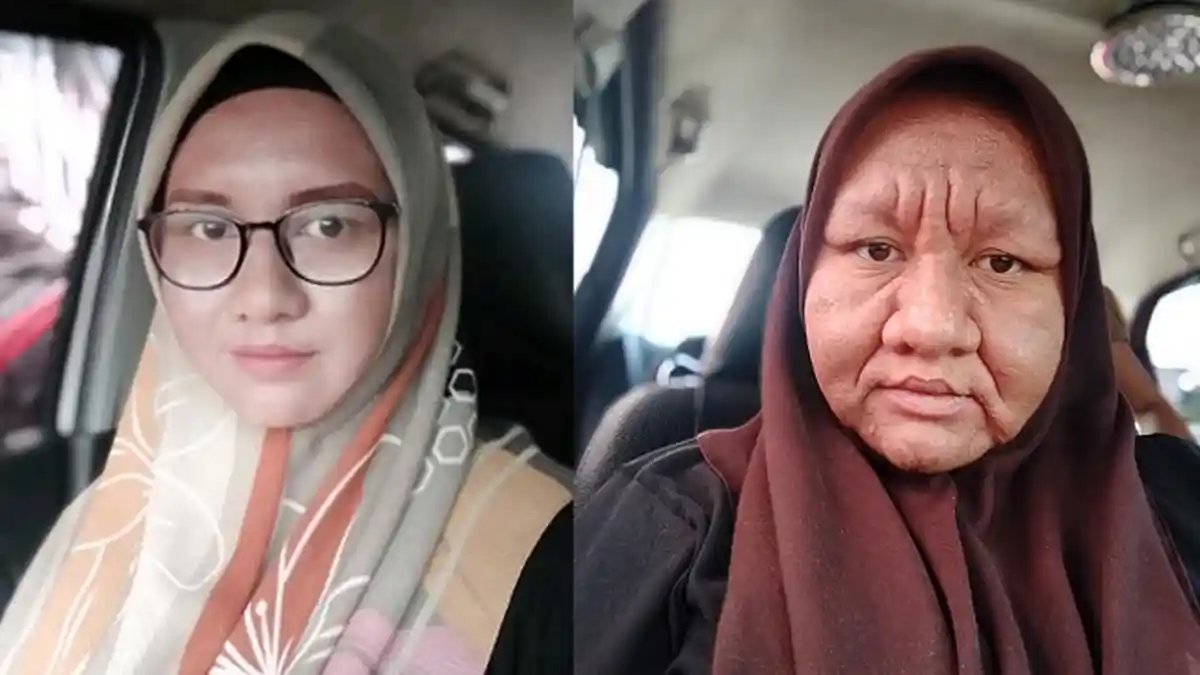 Viral Wanita Ini Alami Perubahan Drastis di Wajah Selama Hamil, Ceritakan Reaksi Suaminya