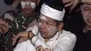 Alih-alih-tersulut-emosi-Gubernur-Jawa-Barat-Dedi-Mulyadi-menunjukkan-sikap-tenang.jpg