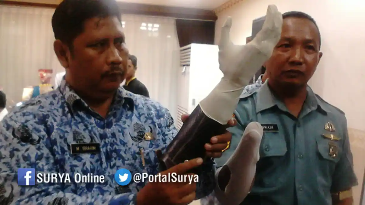 Tentara Korban Granat Pakai Tangan Bionic Pertama di Indonesia