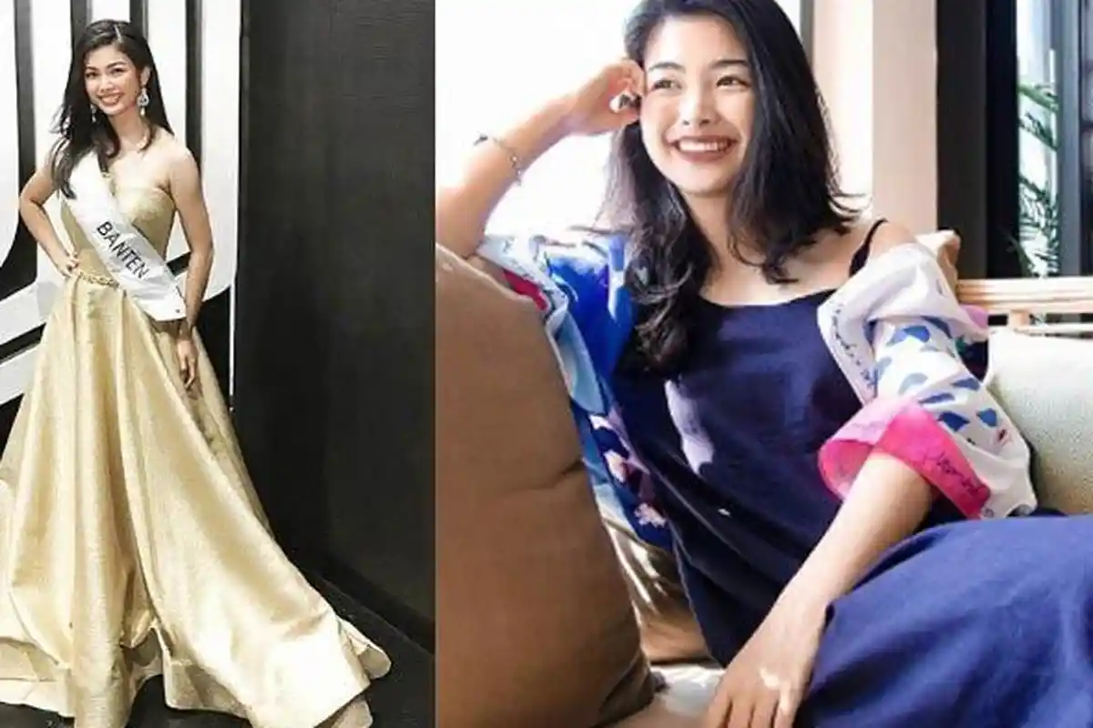 Masih Ingat Elisa Jonathan? Mantan Pacar Nicholas Sean, Calon Dokter Cantik, Pacarnya Kini Tampan