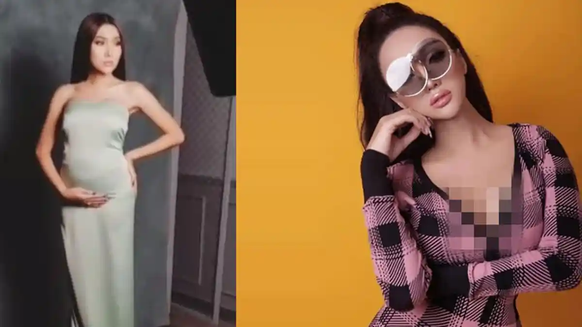 Heboh Lucinta Luna Hamil, Mungkinkah Transwomen Bisa Hamil? Begini Jawaban Ahli