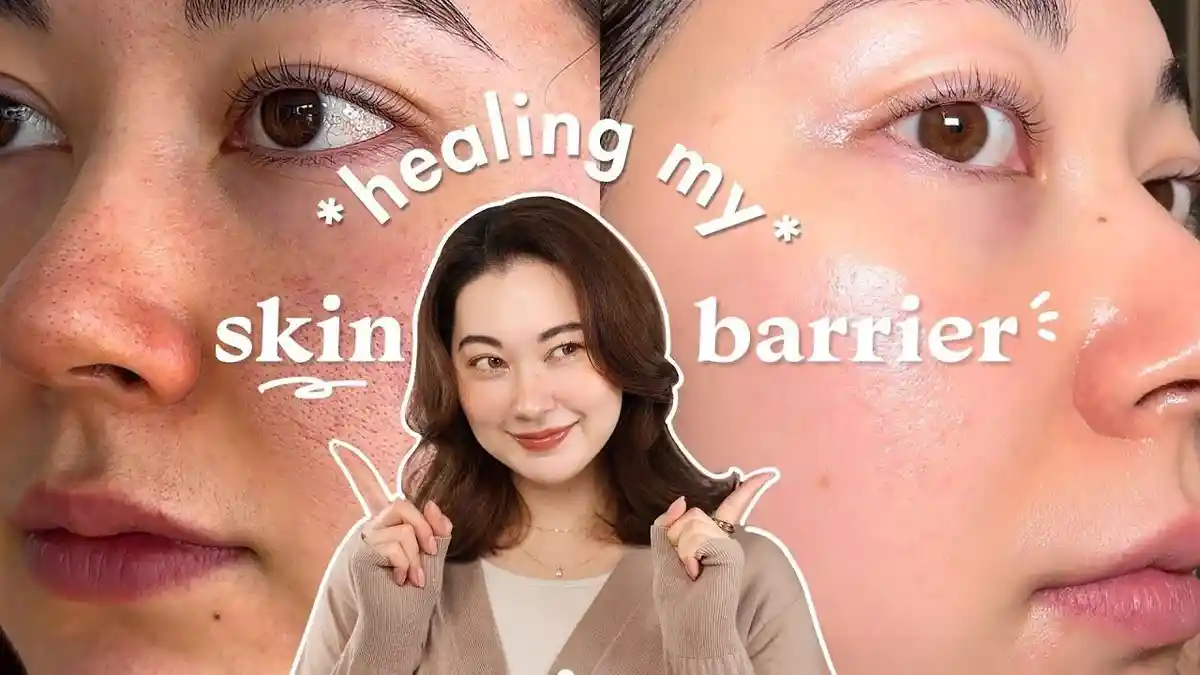 Jangan Asal Pakai Skincare! Ini Tips Memulihkan Skin Barrier yang ...