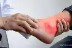 Waspada Asam Urat Kambuh Usai Lebaran, Kenali Penyebabnya agar Tetap Sehat Beraktivitas