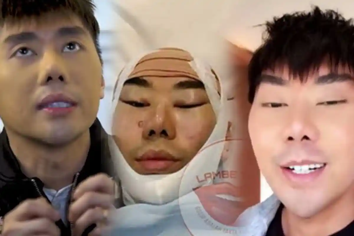 Roy Kiyoshi Akhirnya Jawab Rumor Operasi Plastik, Bahas Dagu Runcing Hingga Komen Netizen