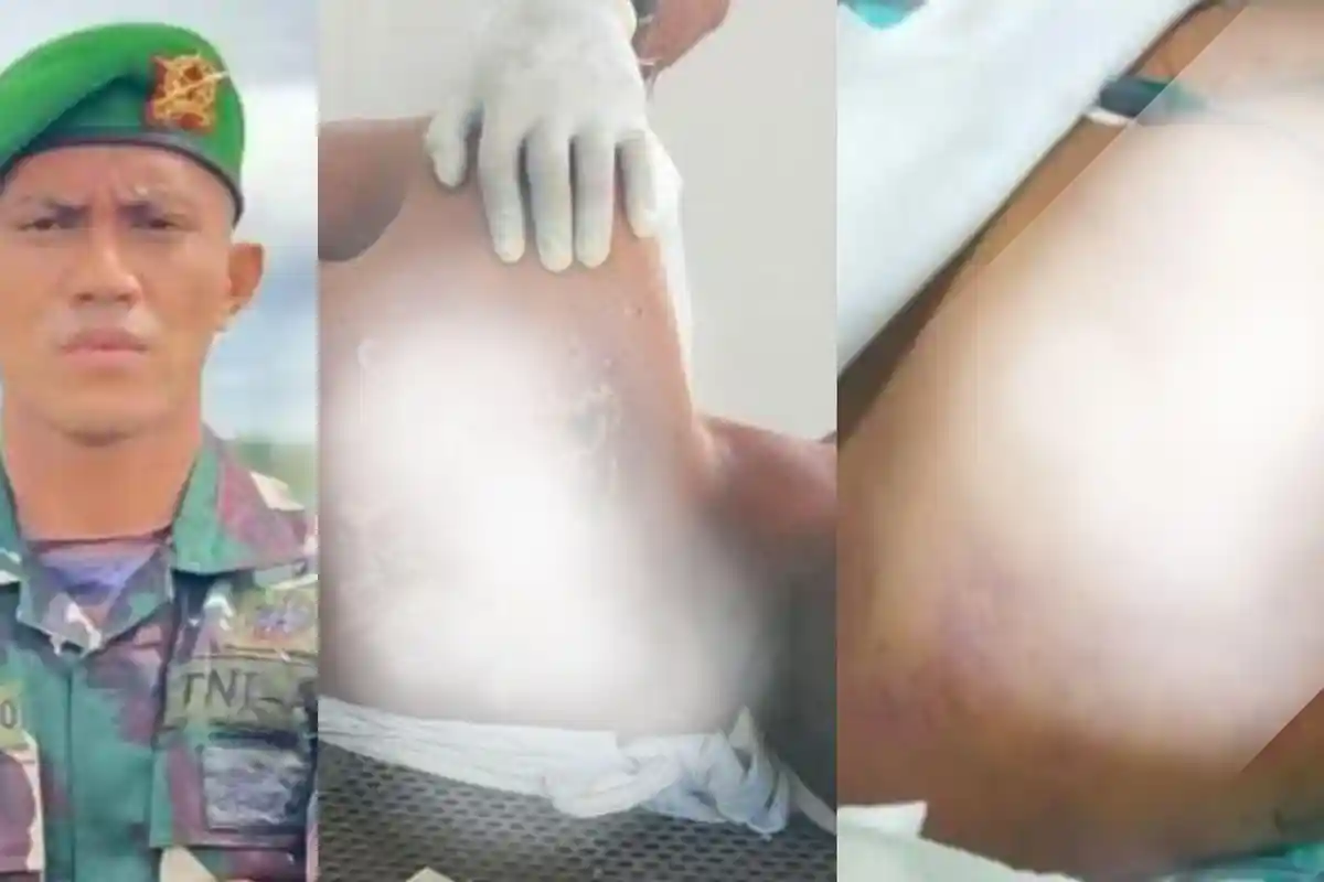 Ada Saksi Baru Bongkar Fakta Mengerikan Detik-detik Prada Lucky Penuh Luka Dibawa ke Puskesmas Danga