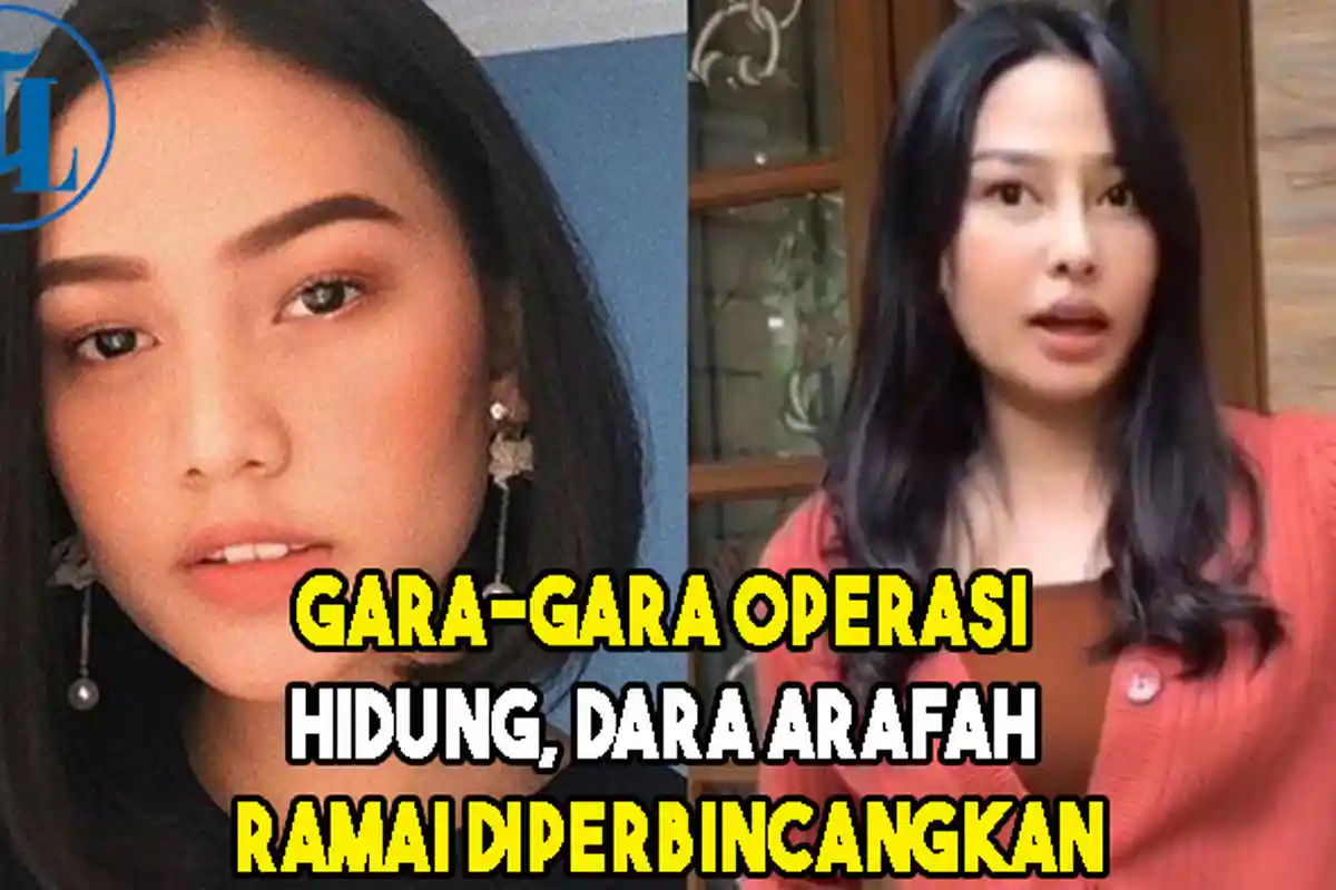 Hidungnya Jadi Perbincangan Hangat, Selebgram Dara Arafah Sebut Sudah Habiskan Uang Capai Rp100 Juta