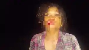 Korban-KDRT-Nofi-Alais-yang-dianiaya-suaminya.jpg