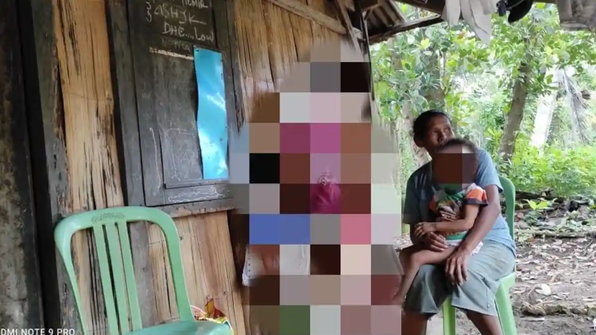 Masih Ingat Balita Korban Penyiksaan Sang Ayah di NTT? Begini Kondisinya Sekarang