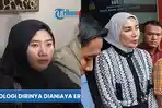 Saling-Serang-Bukti-Erin-Tantang-Eks-ART-Tunjukkan-Bekas-Luka-Penganiayaan-Mana-Bekar-Memarnya.jpg