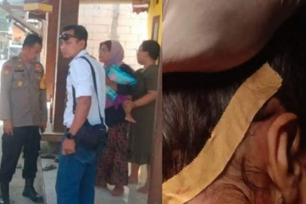 Nasib Balita Digigit Monyet di Gresik, Leher Dapat 40 Jahitan, Polhut Soroti Perilaku Janggal Hewan