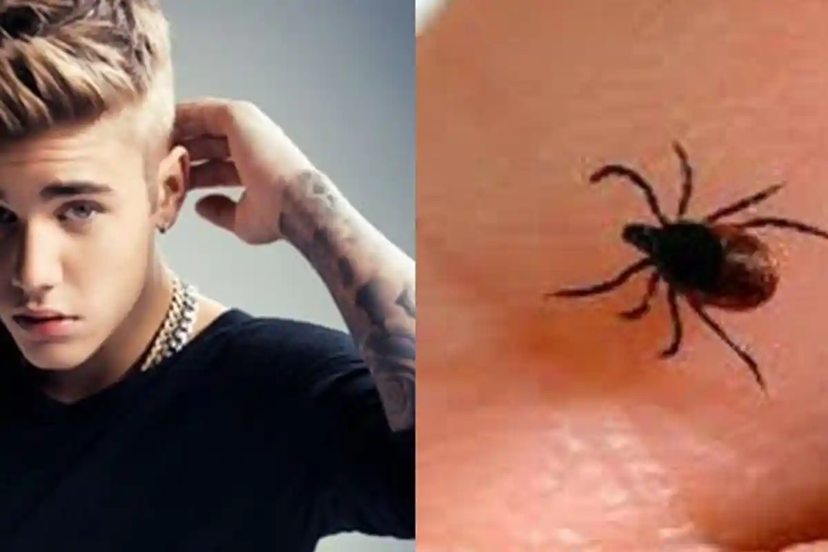Diderita Justin Bieber, Inilah 4 Cara Pencegahan Agar Tidak Terjangkit Penyakit Lyme yang Mematikan