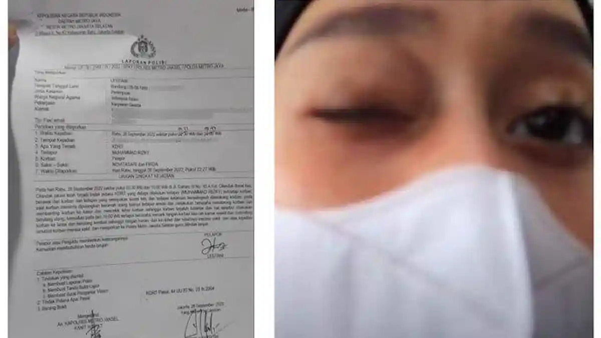 Pasca Laporkan Suaminya, Lesti Kejora Belum Bicarakan Perceraian, Ia Fokus Pulihkan Kondisinya