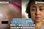 diduga-jadi-korban-malpraktik-filler-rency-milano-alami-bibir-bengkak-dan-dagu-mengeras.jpg