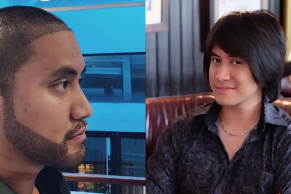 1,5 Bulan setelah Transplantasi Rambut, Kevin Aprilio Ngaku Belum Pede: Pokoknya Butuh 6 Bulan