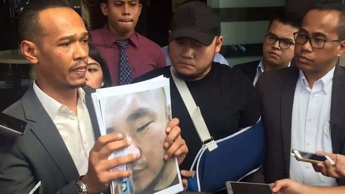 Diduga Lakukan Pengeroyokan, Anggota DPR Asal PDI-P Dilaporkan ke Polisi
