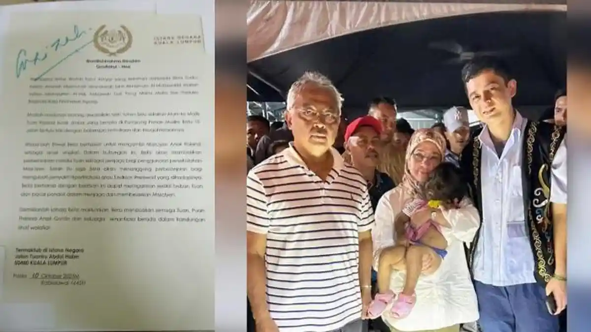 Ratu Malaysia Ingin Adopsi Bayi 2 Tahun yang Idap Werewolf Syndrome